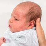 Sarasota fl birth injury lawyer