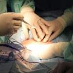 Surgical procedures are often frightening enough for patients without considering the odds of a hospital staff member making a mistake.