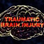 Miami fl slip and fall accident lawyer paralysis and traumatic brain injuries