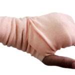 Miami fl slip and fall accident lawyer carpel tunnel syndrome