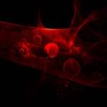 Miami fl slip and fall accident lawyer internal bleeding