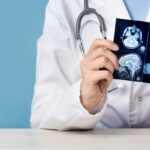 Miami Traumatic Brain Injury Lawyer