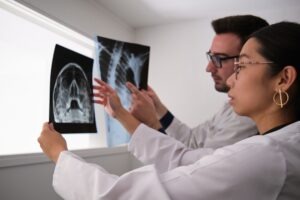 Plantation Traumatic Brain Injury Lawyer