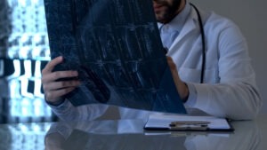 Plantation Spinal Cord Injury Lawyer