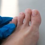 Can I Sue a Nail Salon If I Get an Infection?