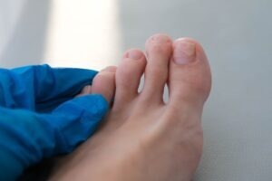 Can I Sue a Nail Salon If I Get an Infection?