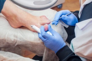 Chalik & Chalik Wins $150K Settlement for Nail Salon Victim